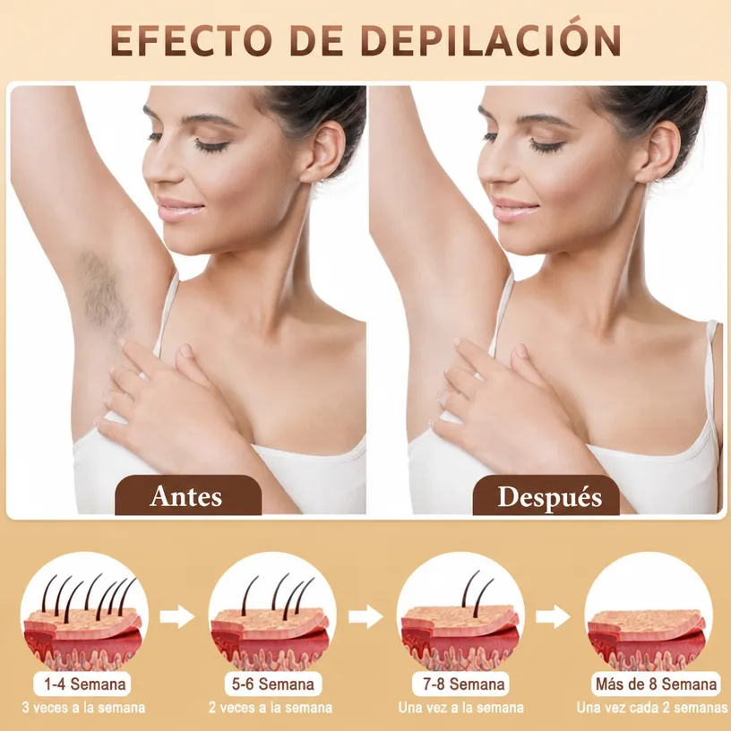 Depiladora IPL Láser para Cuerpo - Image 3